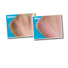 O'Keeffe's For Healthy Feet Daily Foot Cream 3.2 oz