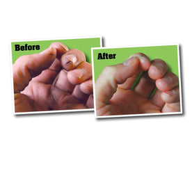 O'Keeffe's Working Hands Skin Cream for Dry Crack & Split 3.4 oz.